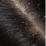 Hair Care Gift Set For Irritated Scalp